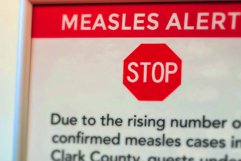 Photograph of a sign reading Measles Alert: STOP.